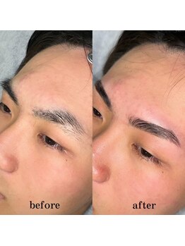 ロアリィ(LOARY)/