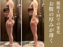 ザ モアナテラス(THE MOANA TERRACE)/痩せなくなってきたことにお悩み