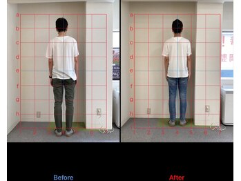 けいのき鍼灸整骨院/姿勢から身体を楽に!整体/肩こり