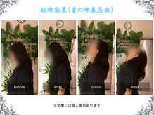 ボディ リセット アンド デザイン(Body Reset & Design)/【施術例】ビフォーアフター