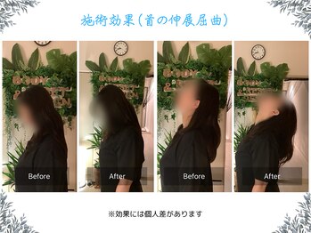 ボディ リセット アンド デザイン(Body Reset & Design)/【施術例】ビフォーアフター