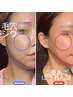 【超特価】最新韓国RFxヴィ＝＞サーマル(200)＋ヴィ2000shot ¥45,000⇒