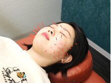 もりわき骨盤鍼灸整骨院 梅田院の雰囲気（お肌本来の美しさを引き出す美容鍼灸♪）