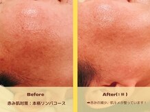 りゅうじんエステサロンの雰囲気（トラブルケア・敏感・エイジング対策・ニキビケア今すぐキレイ）