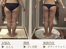 ベレガ 京都店(BELEGA)/◆beforeafter◆