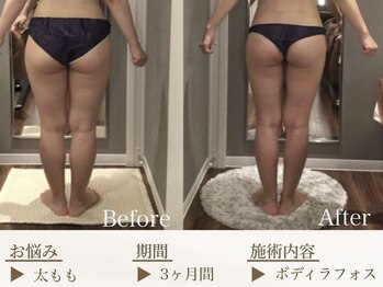 ベレガ 京都店(BELEGA)/◆beforeafter◆