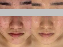 カプロ ボゥ(Capullo.Beau)