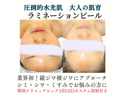キレナル(KIRENAL)の写真