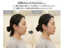 アジール 新潟市(agir)/1cmで横顔が変わる