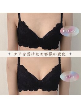 リアン 栄店(Lien)/１回目の施術◎ビフォーアフター