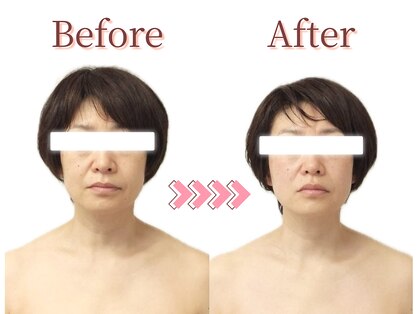 フィオーレ 麻布十番(Fiore)の写真