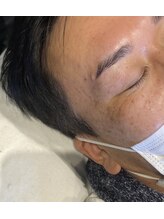 イスリーツー(ithree.2)/パラレルブロウリフト