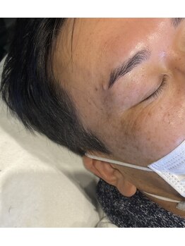 イスリーツー(ithree.2)/パラレルブロウリフト