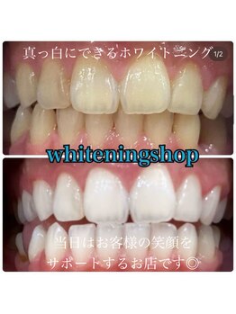 ホワイトニングショップ 柏店/美白ホワイトニング