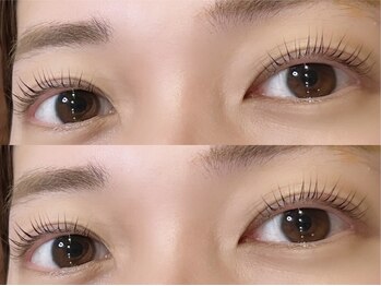 ジッピー オブ トータルビューティー(Zippy of TotalBeauty)の写真/【ラッシュリフトで印象UP】まつげパーマでナチュラルかわいい目元に♪脱毛とお得なセットメニューも◎