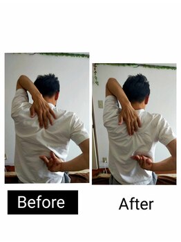 アース エンジェル整体院/ビフォアフ 肩甲骨はがし