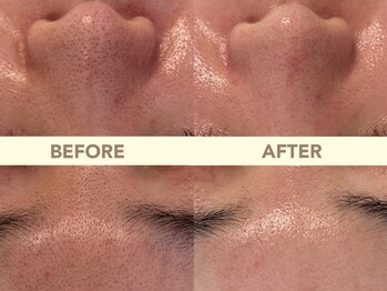 エテルナ(ETERNA)/お肌は変えれます！！