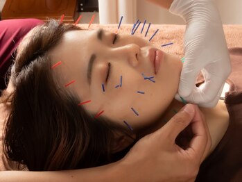 深谷接骨院の写真/美容鍼が初めての方にオススメのお手頃価格!知識・施術経験豊富な国家資格を持つ施術者にご相談ください♪