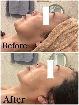 スペチアーレ 夙川/抜群のリフトアップ