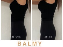 バーミー(BALMY)の雰囲気（最先端で効果的で理想の結果に繋ぐサロン！過去の実績多数あり）