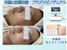 【9月限定】究極の肌質改善:プラズマコース+10月発売の生ビタミンC導入付！