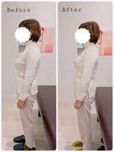 ヒダマリ(HIDAMARI)/猫背矯正