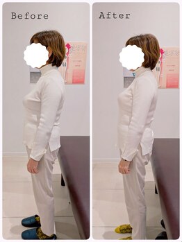 ヒダマリ(HIDAMARI)/猫背矯正