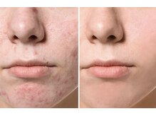 スリリアン 銀座/★お客さまビフォーアフター★