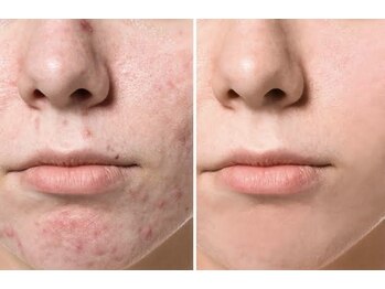 スリリアン 銀座/★お客さまビフォーアフター★