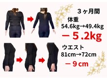 心穏はり灸 整体院/50代女性　Before&After