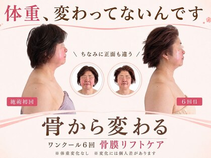 オラ(Ola)の写真