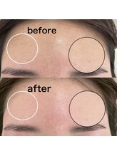 ノワール ブラン(Noir blanc)/美眉WAXとおでこWAX