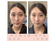 エクラ(Eclat)/小顔+肌質改善+たるみケア専門