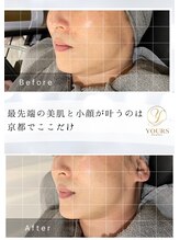 ユアーズ ビューティー(YOURS beauty) 美肌と 小顔を