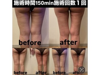 パレス(PALACE)/痩身【下半身】フルコース150min