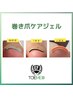 限定モニター価格！巻き爪ケア（２本）
