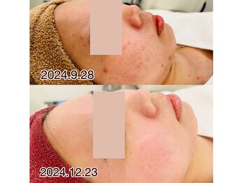 サロンドムーン(salon de MooN)/症例写真