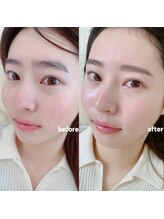 アイル(I’LL)/setで垢抜けられるクーポン☆