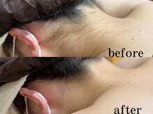 フィノアンド(feino&...)/【エステメニュー】