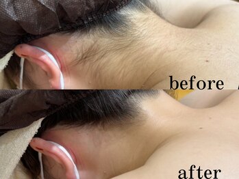 フィノアンド(feino&...)/【エステメニュー】