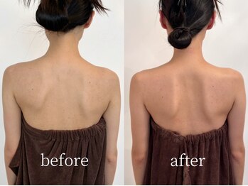 ベレミアム(Bellemium)/Bridal/骨格調整×痩身リンパ