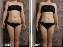 ワールドビューティー(World Beauty)/滝汗デトックス×強圧リンパ痩身