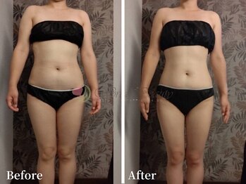 ワールドビューティー(World Beauty)/滝汗デトックス×強圧リンパ痩身