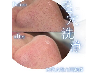 ラブ ザ テラス(Luv the TERRACE)の写真