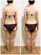 ソレイユ 北千住店(soleil)/お腹まわりをご希望のお客様(3)