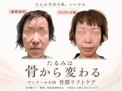 オラ(Ola)の写真