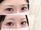 アンフルール ミー(Un Fleur mee)の写真