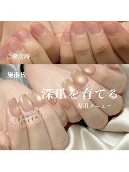 フィグ(Fig)の写真/【深爪育成】深爪でお悩みの方、これから爪を育てたい方におすすめ
