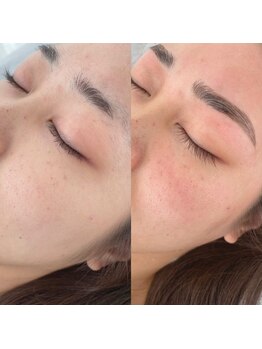 ロアリィ(LOARY)/