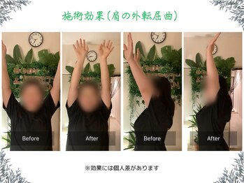 ボディ リセット アンド デザイン(Body Reset & Design)/【施術例】ビフォーアフター